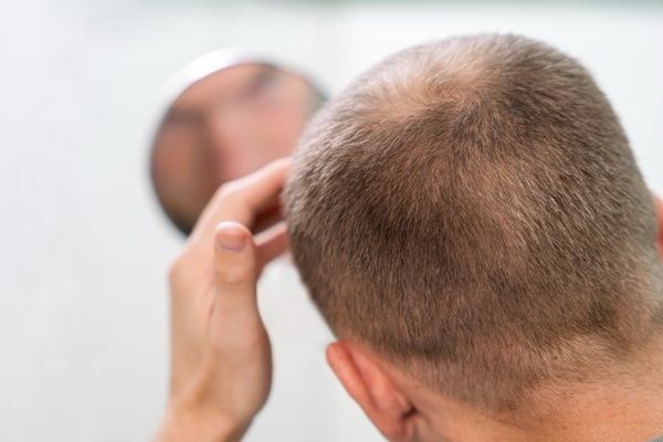 Minoxidil