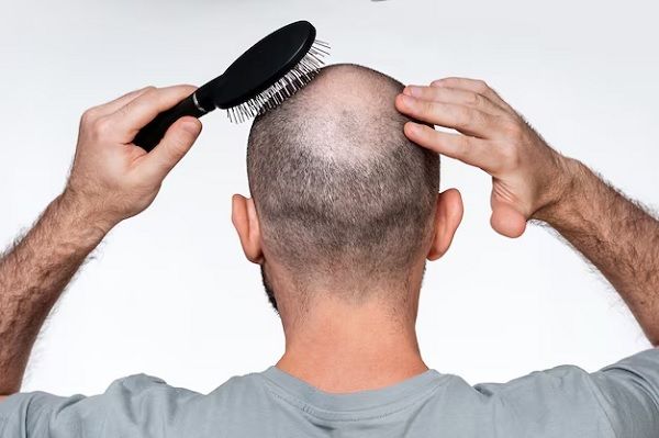 Narbenalopezie 1