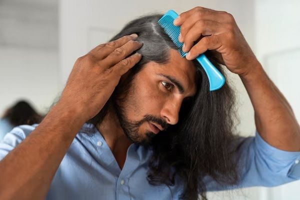 Traction Alopecia 2