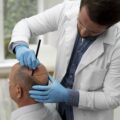 Hairline Design: Definition and Aesthetic Importance